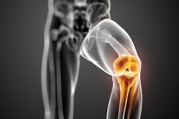 Arthrose de l'articulation du genou