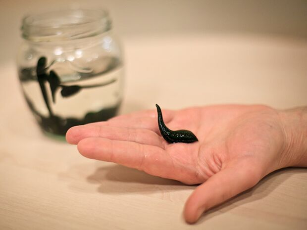 application pour le traitement de l'arthrose de l'articulation du genou